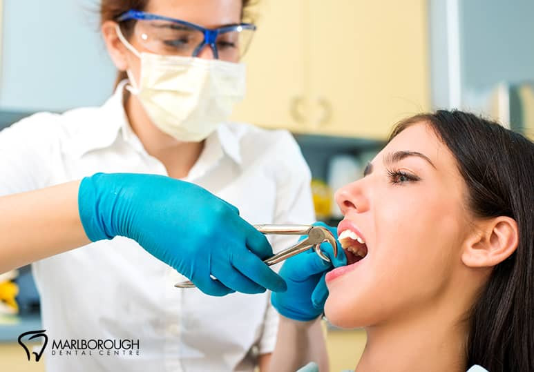 Marlborough Dental - Blog - 5 Reasons Your Dentist May Recommend Tooth Extraction